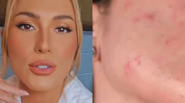 Lívia Andrade tira a maquiagem e choca com situação de seu rosto - Reprodução/Instagram